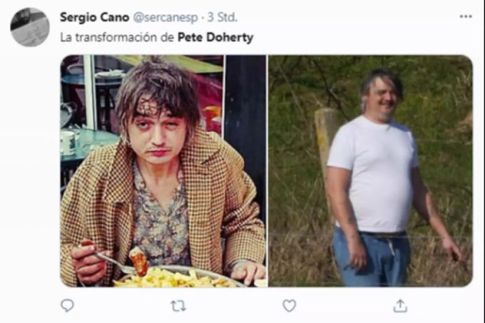 Pete Doherty machte optisch einen grossen Wandel durch. Pete Doherty