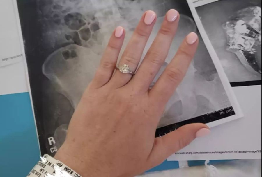 Nach der Operation erhielt sie den 2,4-Karat-Ring wieder zurück.