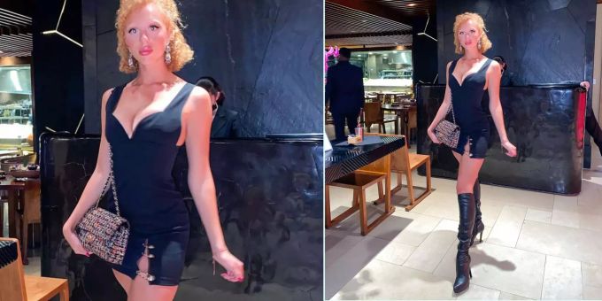 Anna Ermakova - Kleid von Becker-Tochter hält nur mit Sicherheitsnadeln