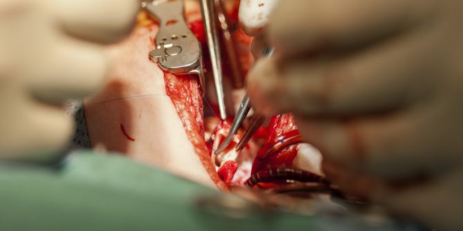 Kleinkind Herz Operation