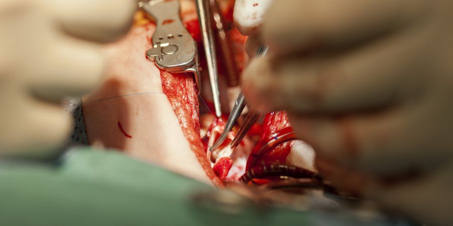 Kleinkind Herz Operation