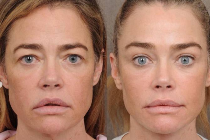 Denise Richards
