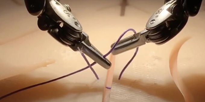 Chirurgie-Roboter lernen jetzt über Videos. Chirurgie Roboter Videos