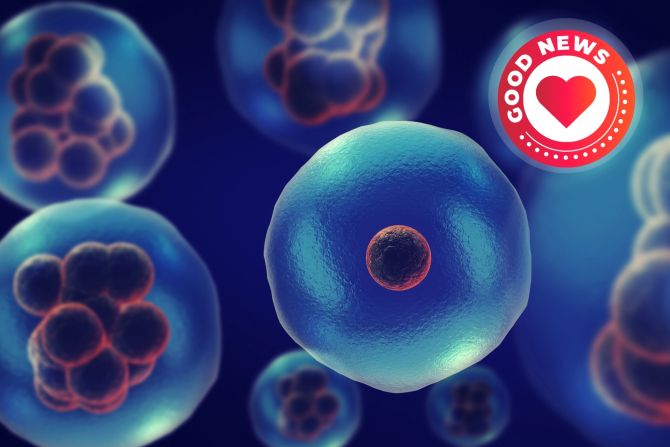 genetische Störung Zellen KI