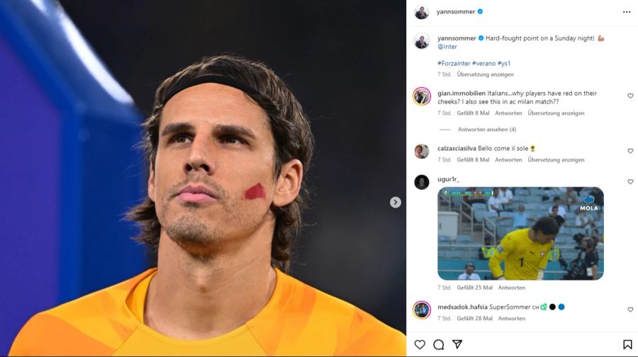 Yann Sommer