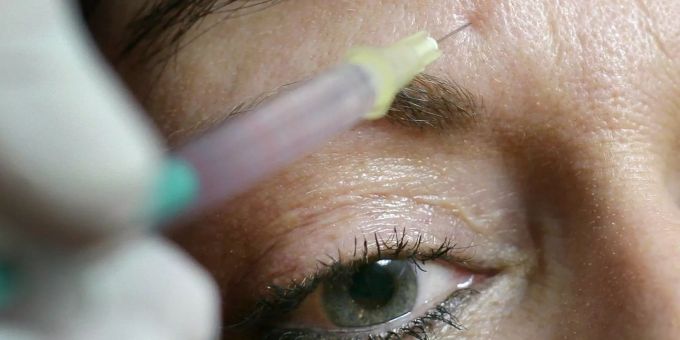 Rund jeder zweite plastische Chirurg nimmt im November und Dezember bis zu 25 Prozent mehr Anti-Falten-Behandlungen vor. Ein Chirurg drückt einer Frau eine Spritze mit «Botox» an die Stirn.