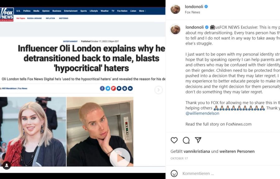 Oli London lässt sich das Gesicht kantiger spritzen.