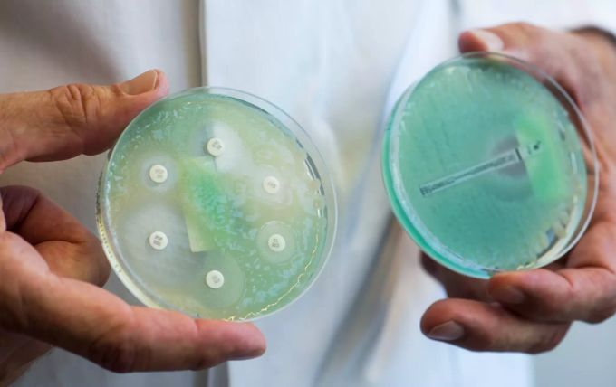 Petrischalen mit sogenannten Krankenhauskeimen, die Mehrfachresistenzen gegenüber Antibiotika aufweisen. (Archivbild Resistente Keime