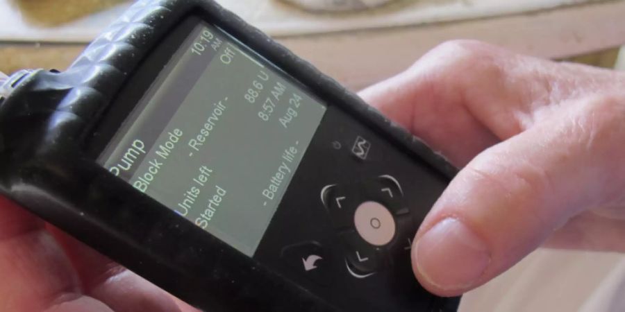 Eine Insulinpumpe erleichtert Diabetikern das Leben, indem sie sie von der Notwendigkeit der andauernden Kontrolle entlastet. Doch dazu muss man erst wissen, dass man die Krankheit hat. In der Schweiz ist Diabetes mellitus gemäss einer OBSAN-Studie in hohem Masse unterdiagnostiziert. (Symbolbild)
