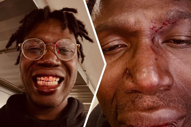 YB-Fan nach Basel-Spiel brutal zusammengeschlagen