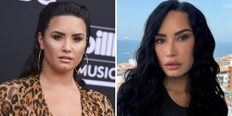 «Was hast du getan?» - Fans vermuten: Demi Lovato war beim Beauty-Doc