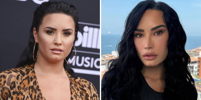 «Was hast du getan?» - Fans vermuten: Demi Lovato war beim Beauty-Doc «Was hast du getan?» - Fans vermuten: Demi Lovato war beim Beauty-Doc