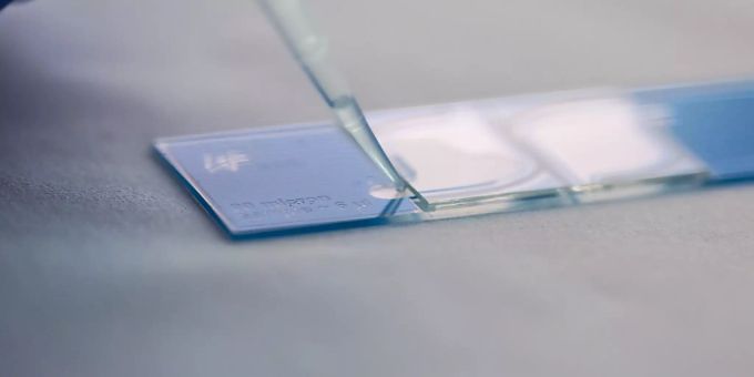 Die Spermienzahl wird mit einer speziellen Zählkammer unterm Mikroskop bestimmt. Eine Infektion mit dem Coronavirus könnte zu einer Verringerung der Spermien beitragen. Spermien