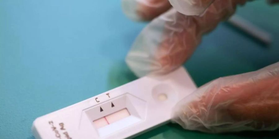 Auch bei einem Corona-Schnelltest ist ein Abstrich erforderlich. Ist das Virus in der Probe enthalten, reagieren dessen Eiweissbestandteile mit dem Teststreifen. Foto: Marijan Murat/dpa
