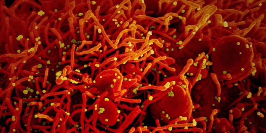 Aufnahme eine Zelle (rot), die mit dem Coronavirus (SARS-CoV-2, gelb) infiziert ist. Foto: Niaid/Europa Press/dpa