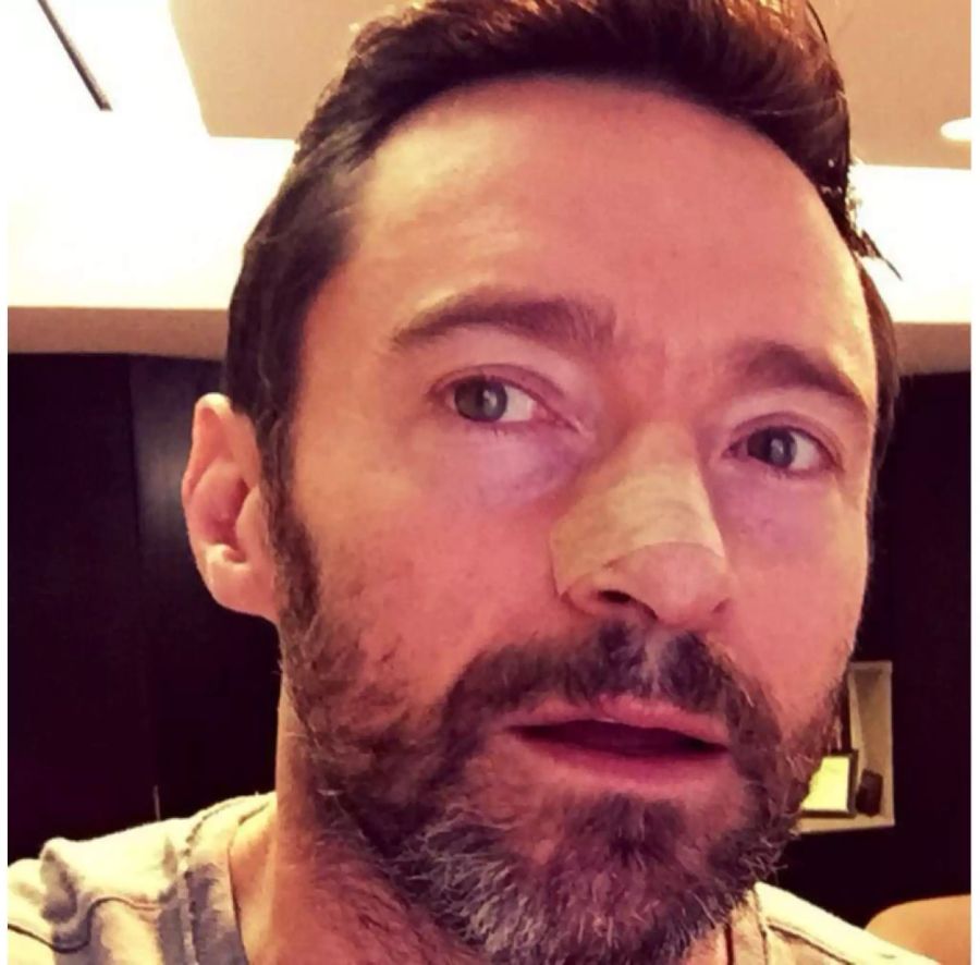 Jackman warnt seine Fans immer wieder vor schädlichen UV-Strahlen.