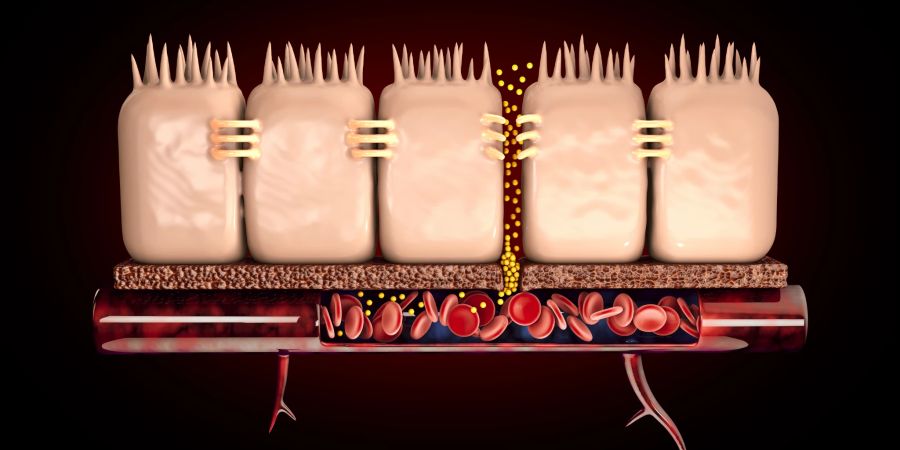 Beim Leaky-Gut-Syndrom sind die Darmschleimhäute beschädigt und so können Substanzen in den Blutkreislauf gelangen, die dort nicht hin sollten.