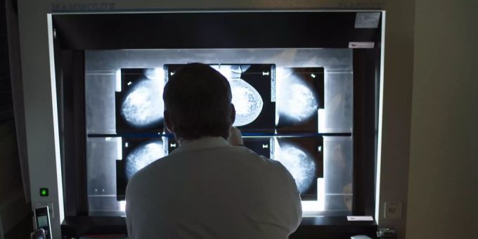 Künstliche Intelligenzen sollen bei der Früherkennung von Brustkrebs helfen können. Künstliche Intelligenz Google KI