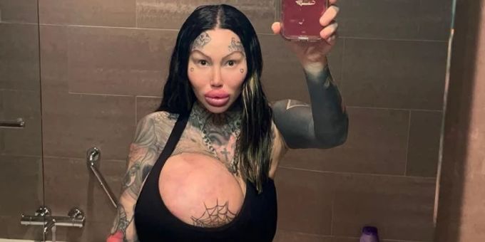 Implantat geplatzt! - Influencerin hat jetzt nur noch eine XXL-Brust