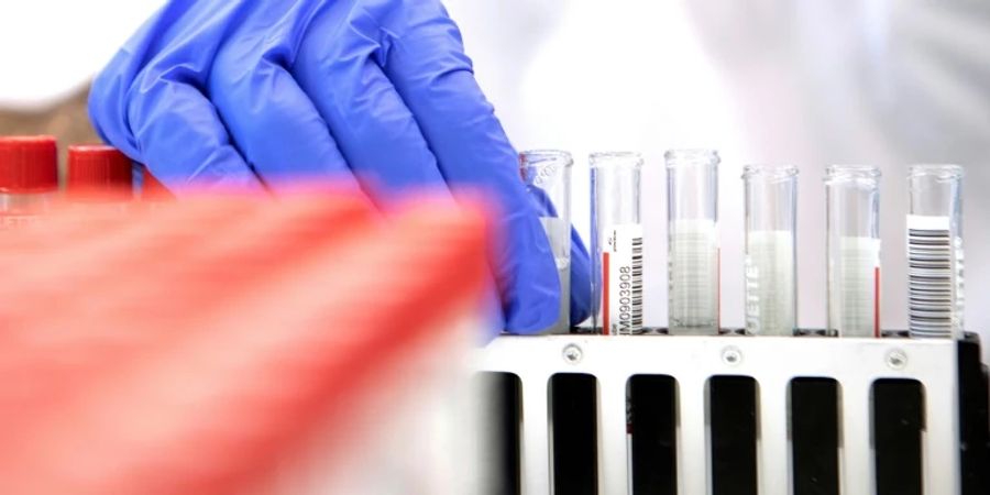 PCR-Test im Labor