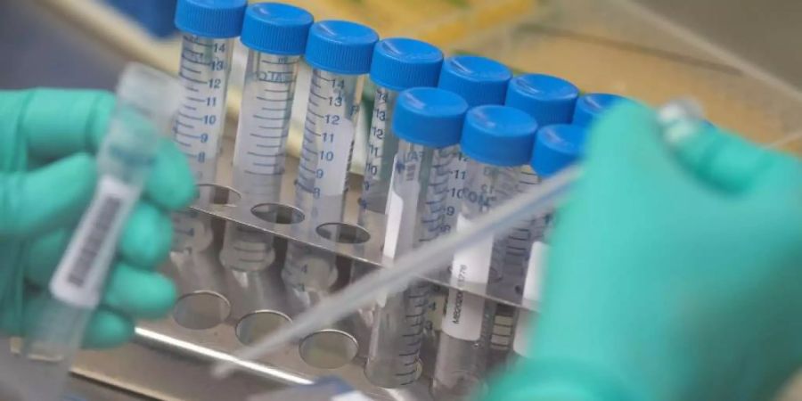 Eine Mitarbeiterin des Landesgesundheitsamts Baden-Württemberg pipettiert Proben. Foto: Marijan Murat/dpa