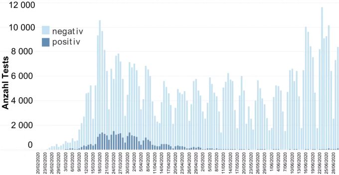 Die Anzahl Tests in der Schweiz liegt derzeit höher als zu Beginn der Corona-Krise Mitte März. Coronavirus Tests Schweiz