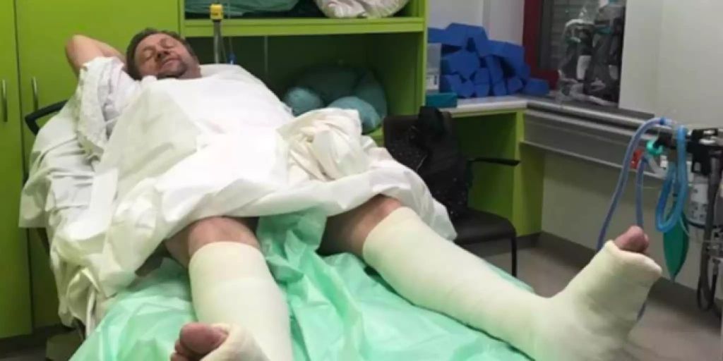 SVPNationalrat Nicolet hat beide Beine im Gips