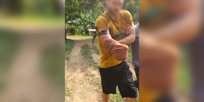 Ein Schweizer ist in Thailand von einem Bären angegriffen worden. Bär Thailand