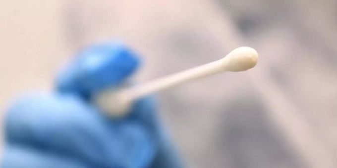 Eine Hand hält Tupfer, mit dem ein Abstrich für einen Coronatest gemacht wird. Foto: Karl-Josef Hildenbrand/dpa Eine Hand hält Tupfer, mit dem ein Abstrich für einen Coronatest gemacht wird. Foto: Karl-Josef Hildenbrand/dpa