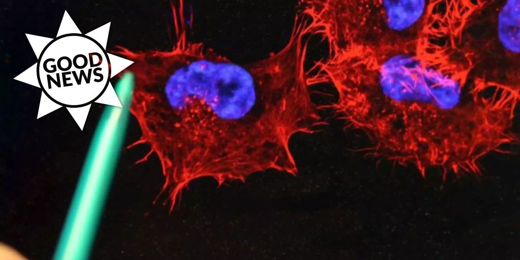 Researchers have discovered a new successful way to destroy cancer cells