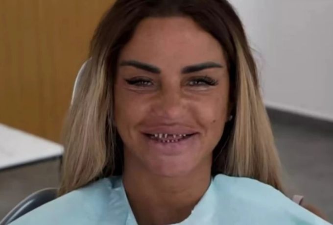 So sieht Katie Price übrigens ohne Keramikzähne aus. Katie Price