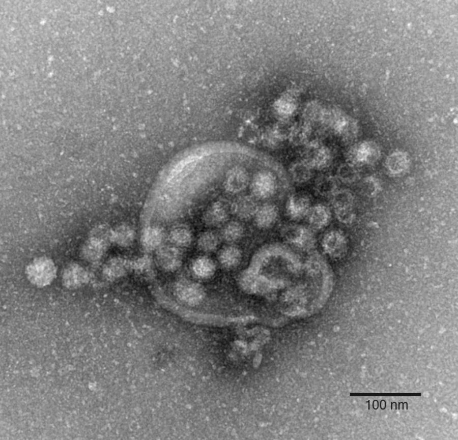 Norovirus Elektronenmikroskop