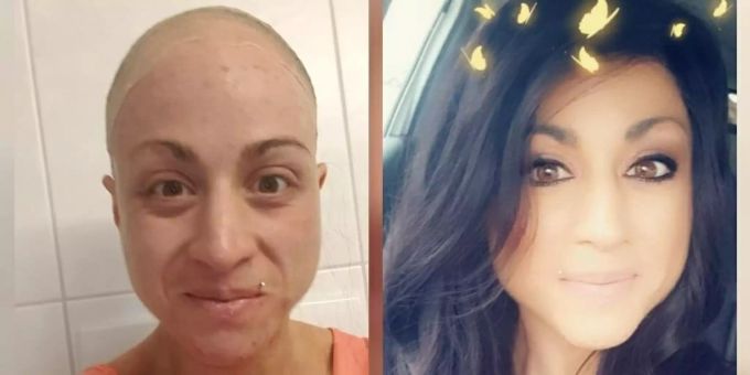 Claudia Walden hat aufgrund ihrer eigenen Leidensgeschichte den Hairpalace gegründet. Hairpalace Claudia Walden Dielsdorf