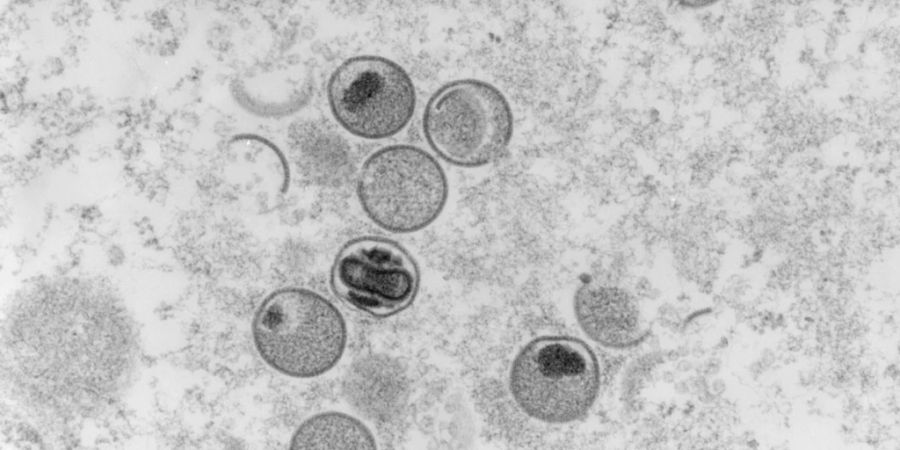 Elektronenmikroskopische Aufnahme von Affenpocken-Viren. In der Schweiz sind bis Montag 416 Fälle von Affenpocken aufgetreten. (Archivbilld)