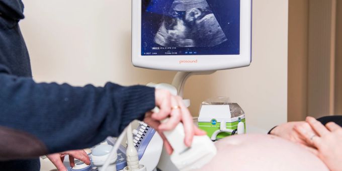 Ein Arzt untersucht eine schwangere Frau mit einem Ultraschallgerät während der Fötus im Mutterbauch auf einem Display zu sehen ist. ultraschall fötus