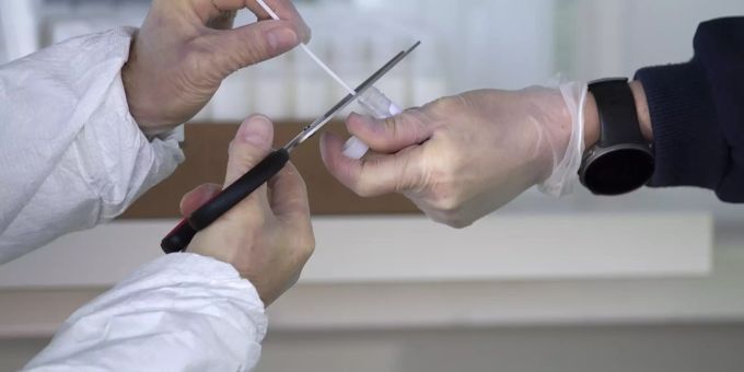 Das Stäbchen mit dem Abstrich eines für Covid-19 getesteten Person wird in ein Plastikfläschen gesteckt. Coronavirus