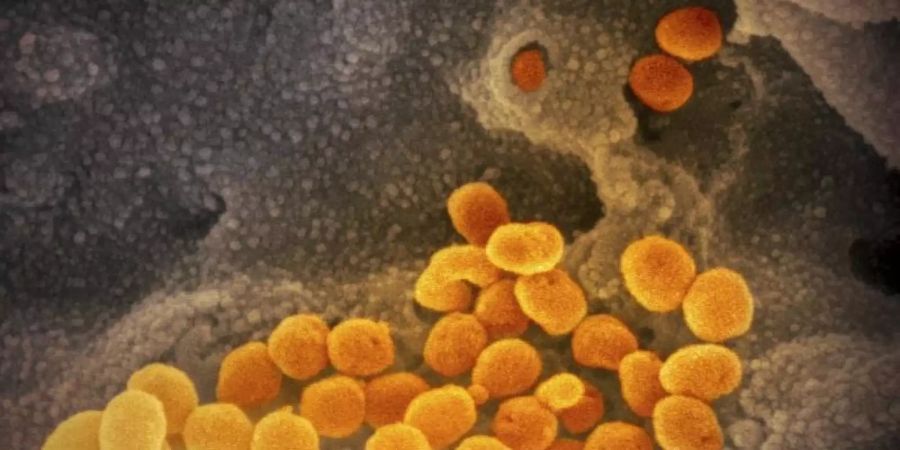 Das Coronavirus passt sich durch Mutationen ständig seinem neuen Wirt, dem Menschen, an. Wie gefährlich die neue Virusvariante ist, wurde noch nicht abschliessend geklärt. Foto: NIAID-RML/AP/dpa