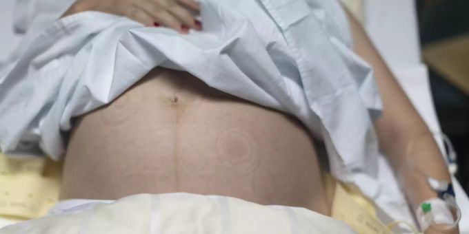Eine hochschwangere Frau wollte keinen Test auf das Coronavirus machen und wurde vom Spital Schwyz deshalb abgewiesen. (Symbolbild) Coronavirus