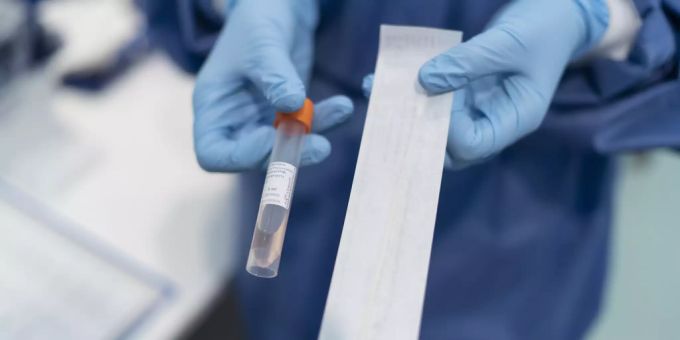 Medizinisches Personal führt einen Covid-Schnelltest durch. Coronavirus Schnelltest