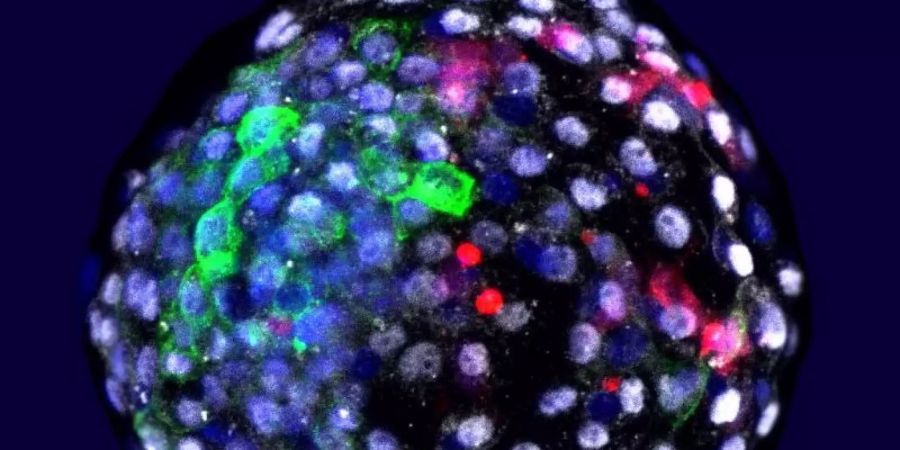 Das Bild zeigt eine Chimäre Mensch-Affe-Blastozyste. Wissenschaftler haben Embryonen aus Zellen von Mensch und Affe erzeugt. Foto: Weizhi Ji/Kunming University of Science and Technology/dpa