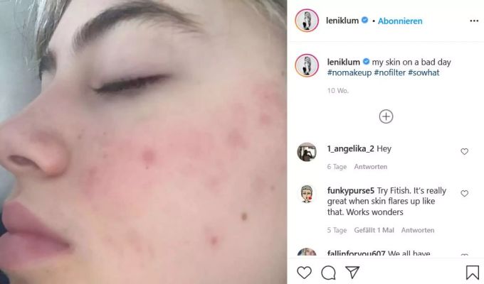 Leni Klum lebt Natürlichkeit auch auf Instagram. heidi klum