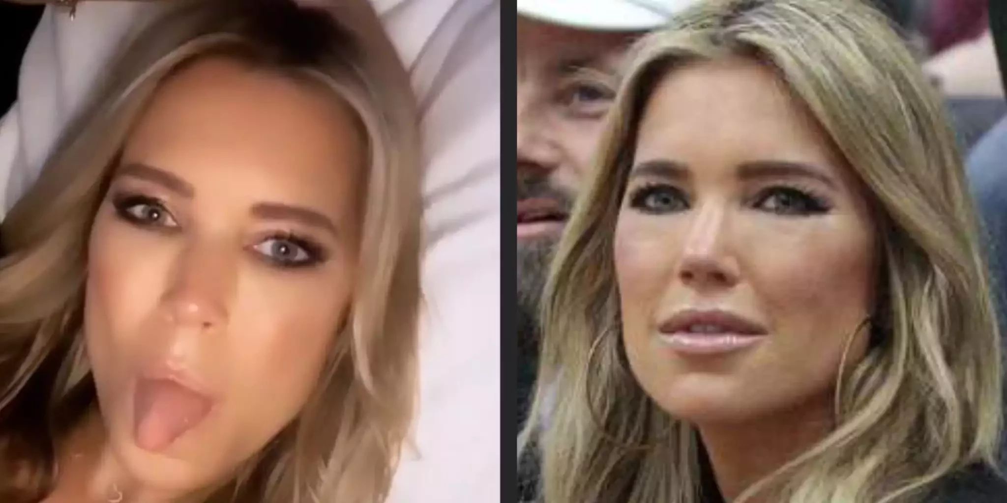 Ops Botox Sylvie Meis: Was Ist Mit Ihrem Gesicht Passiert? – GPJJO