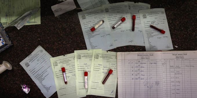 Blutproben von Patienten in Indien, bei denen der Verdacht besteht, dass sie an Dengue-Fieber leiden. (Symbolbild) Dengue Fieber