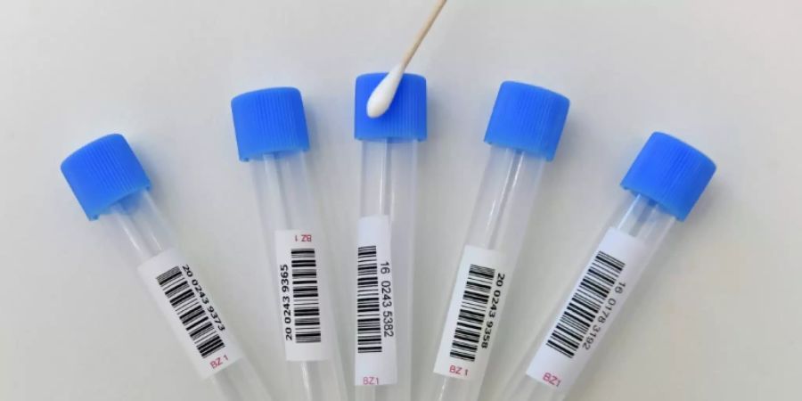Teströhrchen für Coronatests liegen bereit