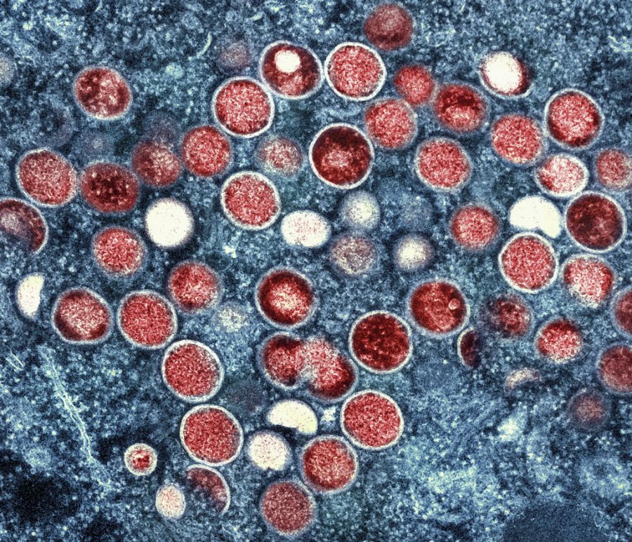 mpox virus Mikroskopie