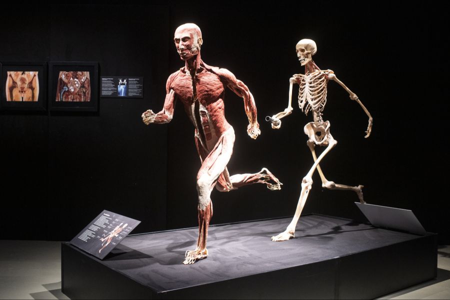 Plastinate