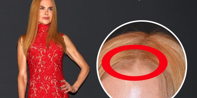 Nicole kidman
