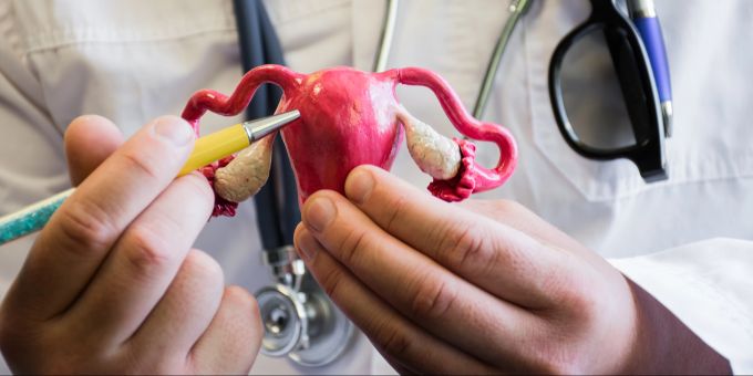 Frauengesundheit - Was sind die Anzeichen für Eierstockkrebs?