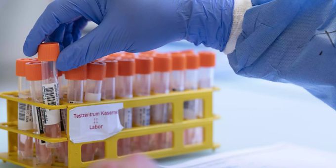 Corona-Proben werden in einem Labor verarbeitet. (Archivbild) coronavirus