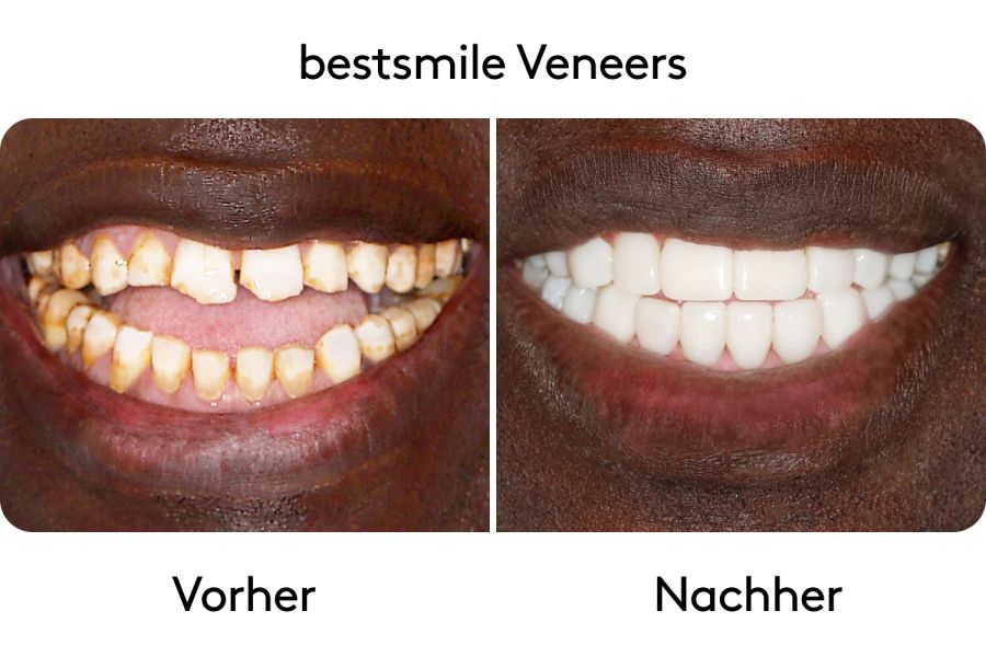 Vorher-Nachher Bilder